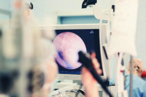 Equipping AI Medical Carts with Endoscopy Video Capture
